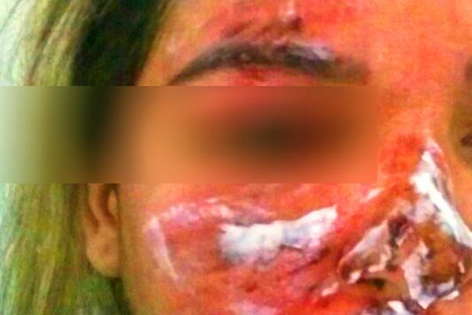 ROSTO DESFIGURADO - Com bebê de 7 meses no colo, mulher é espancada pelo marido - News Rondônia