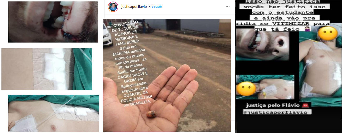 Protesto pede justiça para rondoniense atingido por tiros durante confusão no Acre: PM se apresenta na Delegacia - News Rondônia