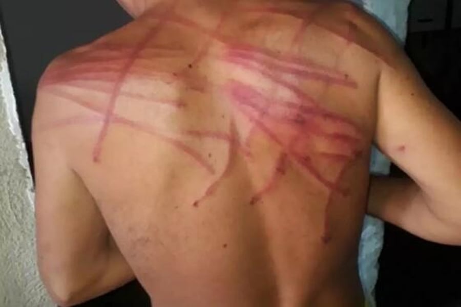 `Patrão´ se revolta com cobrança e dá chicotadas em ex-funcionário - News Rondônia