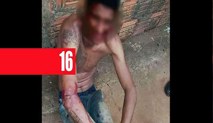 JOVEM É CONFUNDIDO COM MEMBRO DE FACÇÃO E QUASE É MORTO APÓS SÉRIE DE ESPANCAMENTO - News Rondônia