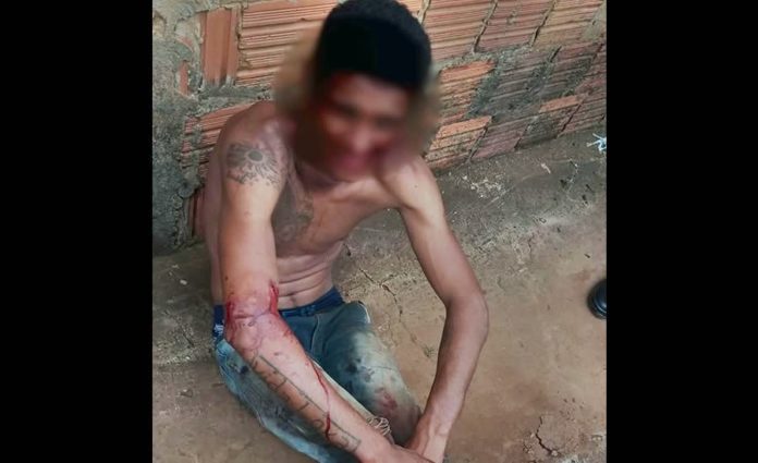 JOVEM É CONFUNDIDO COM MEMBRO DE FACÇÃO E QUASE É MORTO APÓS SÉRIE DE ESPANCAMENTO - News Rondônia