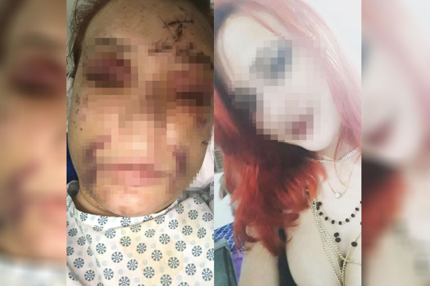 REVIRAVOLTA EM TENTATIVA DE HOMICÍDIO INCRIMINA MOTORISTA DE APP - News Rondônia