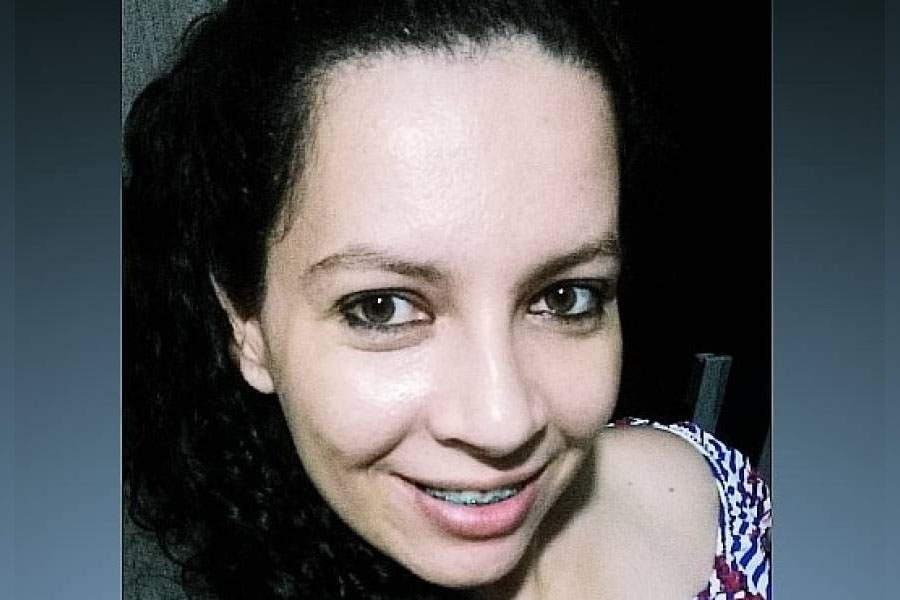Após acidente envolvendo carro de vereadora dirigido por marido, ex-vereador, dona de moto atingida aciona a polícia - News Rondônia