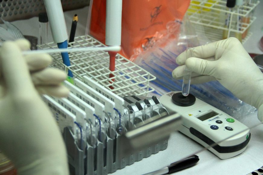 SESAU IMPLANTA EXAME PARA DETECÇÃO DO VÍRUS DA GRIPE NO LACEN; RESULTADOS QUE DEMORAVAM 30 DIAS SAEM EM UMA SEMANA - News Rondônia