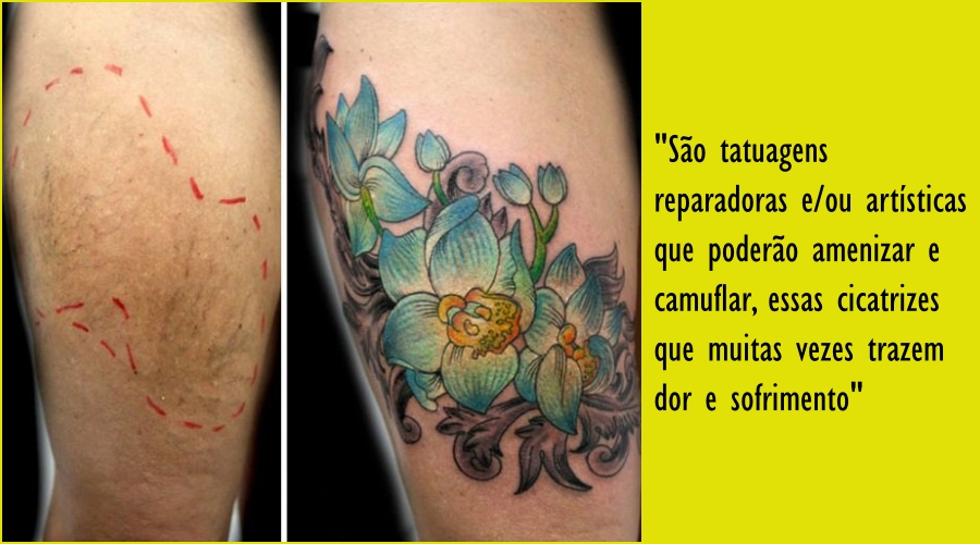 Avança projeto que prevê tatuagens para mulheres vítimas de violência pelo SUS - News Rondônia