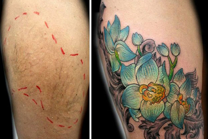 Avança projeto que prevê tatuagens para mulheres vítimas de violência pelo SUS - News Rondônia