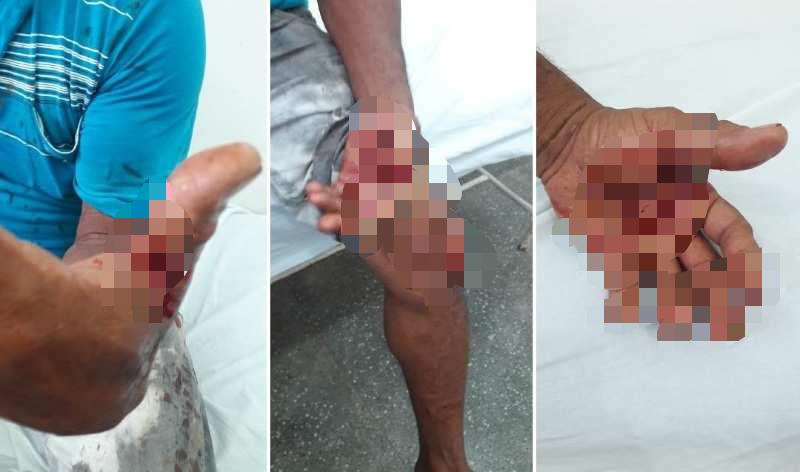 VIOLÊNCIA - Homem é baleado e esfaqueado durante roubo em residência na capital
