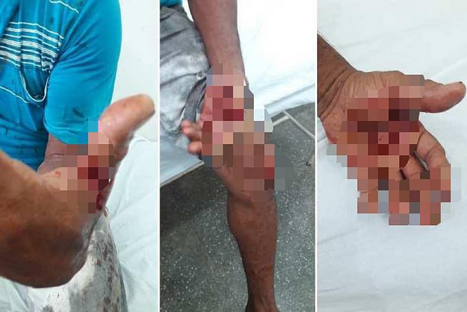 VIOLÊNCIA - Homem é baleado e esfaqueado durante roubo em residência na capital - News Rondônia