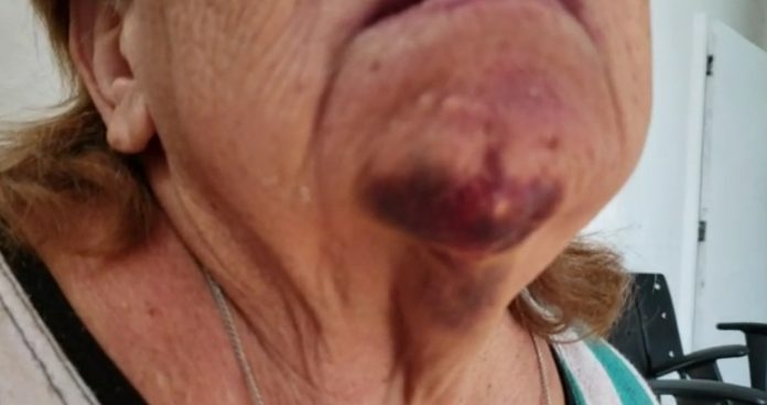 JOVEM É PRESO POR AGREDIR A MÃE DE 74 ANOS - News Rondônia