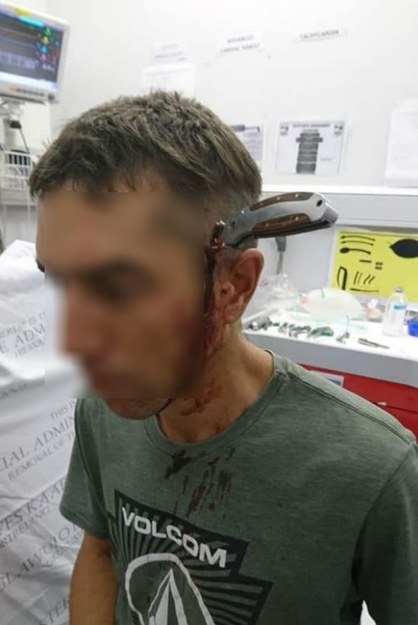 APÓS RECEBER FACADA NA CABEÇA, CICLISTA PEDALA EM BUSCA DE AJUDA - IMAGEM FORTE - News Rondônia