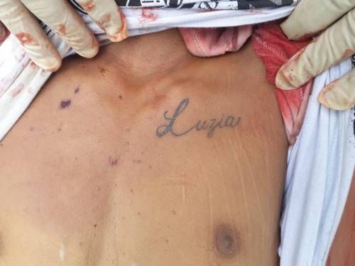 ADOLESCENTE DE 15 ANOS É EXECUTADO COM TRÊS TIROS NA CABEÇA - News Rondônia