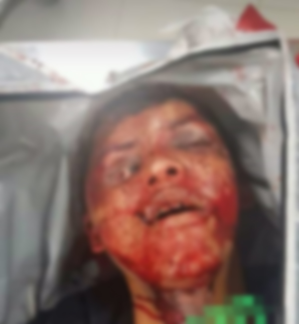 IMAGENS FORTES: TRAFICANTE DA FACÇÃO FDN É EXECUTADO A TIROS POR MEMBROS DO COMANDO VERMELHO EM MANAUS - News Rondônia