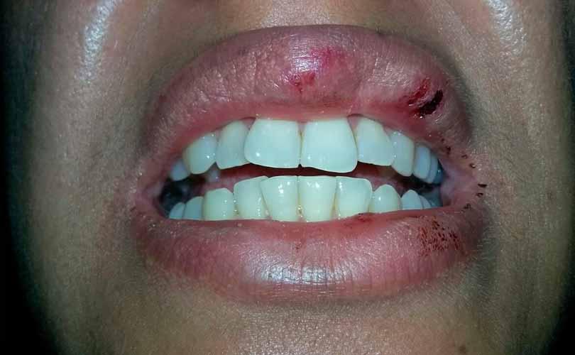 COVARDE: HOMEM BATE NA MULHER PORQUE ELA NÃO QUERIA DEIXAR ELE SAIR - News Rondônia
