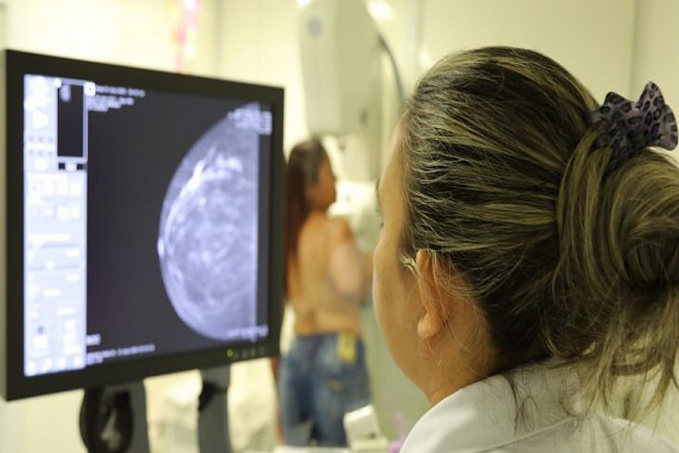Carreta de mamografia do hospital de amor, estará em Jaru em julho - News Rondônia