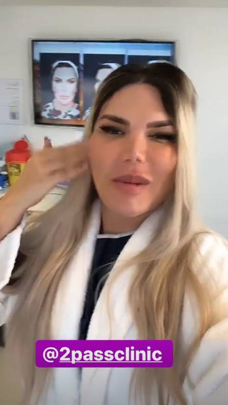 PROCEDIMENTO: EX-KEN HUMANO FAZ CIRURGIA DE R$ 112 MIL PARA FEMINIZAR O ROSTO - News Rondônia