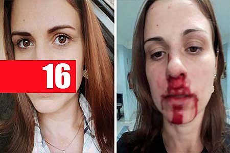 MULHER DENUNCIA EX-MARIDO APÓS LEVAR SOCO NO NARIZ - News Rondônia