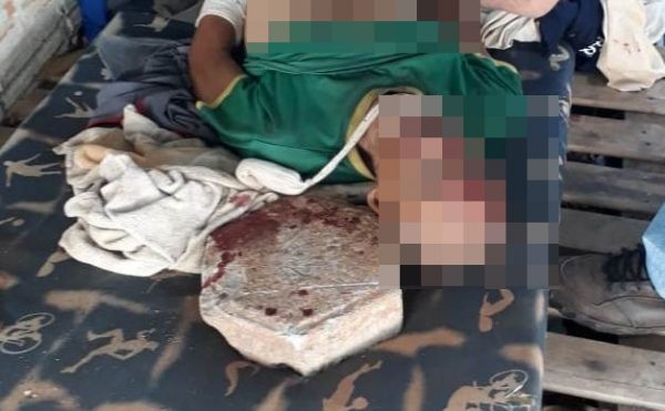 UM DOS PRIMEIROS CHAPAS DE VILHENA É MORTO À PEDRADA NO LOCAL ONDE TRABALHOU POR MUITOS ANOS - News Rondônia