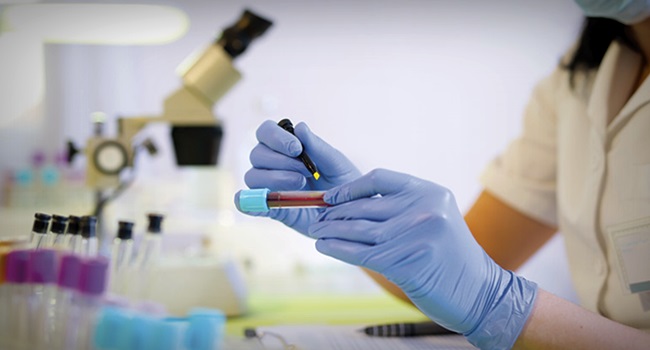 SANGUE DOURADO: IRMÃS BRASILEIRAS POSSUEM TIPO SANGUÍNEO MAIS RARO DO MUNDO - News Rondônia