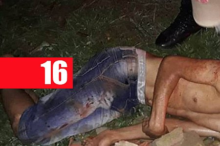 BALEADO EM BOCA-DE-FUMO, RAPAZ DE 18 ANOS DESPISTA ASSASSINOS E ESCAPA DE EXECUÇÃO - News Rondônia