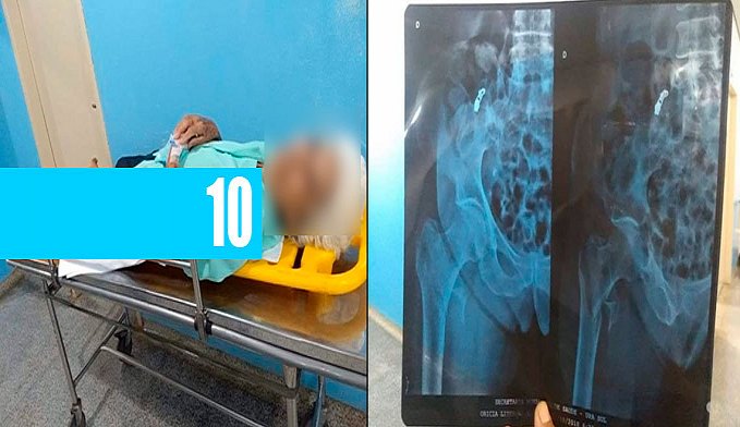 IDOSA DE 80 ANOS QUEBRA A PERNA AO SER ATROPELADA E FAMÍLIA PRECISA PAGAR AMBULÂNCIA PARA TRANSFERÊNCIA AO JOÃO PAULO II - News Rondônia