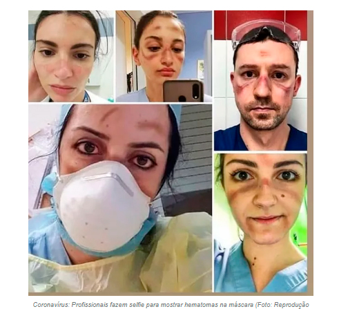 CORONAVÍRUS: MÉDICOS FAZEM SELFIE PARA MOSTRAR DIAS COMBATENDO O VÍRUS - News Rondônia