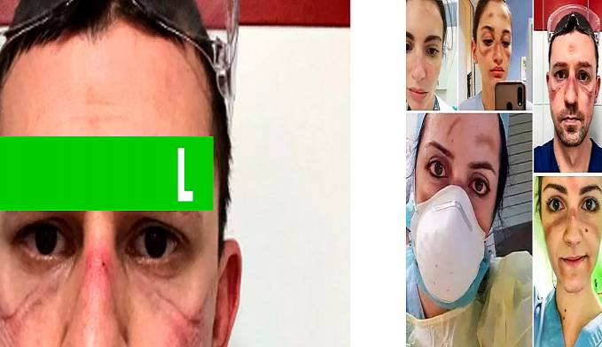 CORONAVÍRUS: MÉDICOS FAZEM SELFIE PARA MOSTRAR DIAS COMBATENDO O VÍRUS - News Rondônia