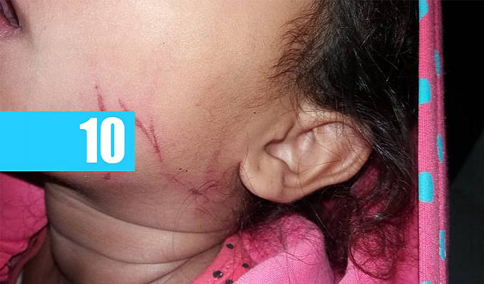 ENDIABRADA: Denunciada por espancar a própria filha de 4 anos, mulher embriagada é presa; criança é entregue à avó - News Rondônia