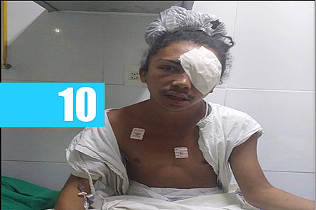 ADOLESCENTE É APREENDIDO ACUSADO DE ATIRAR EM TRAVESTI EM TERESINA - News Rondônia