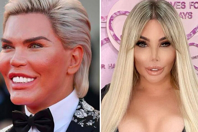 Transexual Jéssica Alves quer implantar útero - News Rondônia