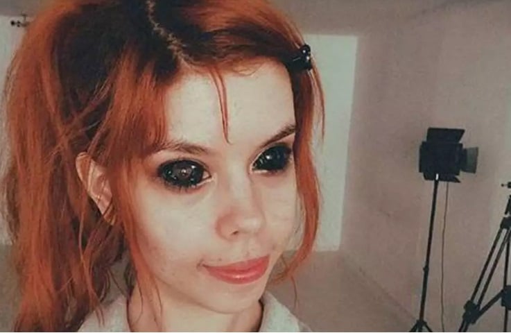 MÁ IDEIA: JOVEM DE 25 ANOS FICA CEGA APÓS TENTAR TATUAR OS OLHOS DE PRETO - News Rondônia