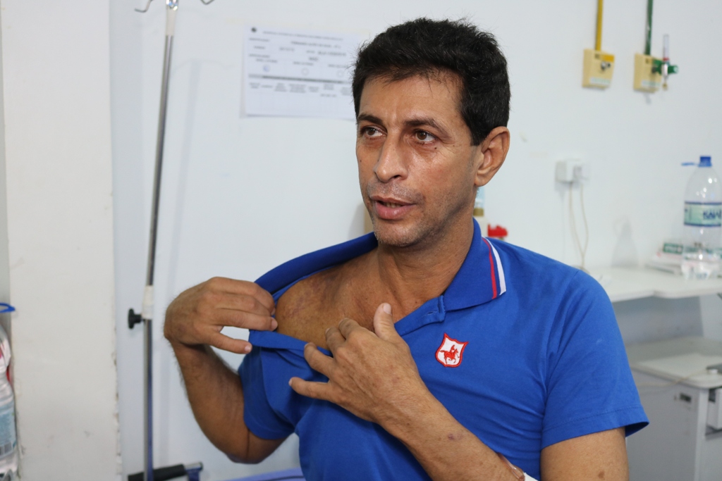 EQUIPE DO HOSPITAL DE BASE ARY PINHEIRO REALIZA A PRIMEIRA CIRURGIA ENDOVASCULAR DE LESÃO TRAUMÁTICA NO ESTADO - News Rondônia