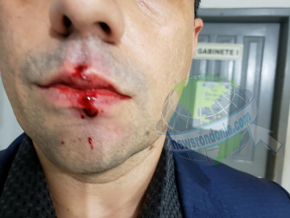 ADVOGADO BRENO MENDES É AGREDIDO NA CENTRAL DE FLAGRANTES - VÍDEO - News Rondônia