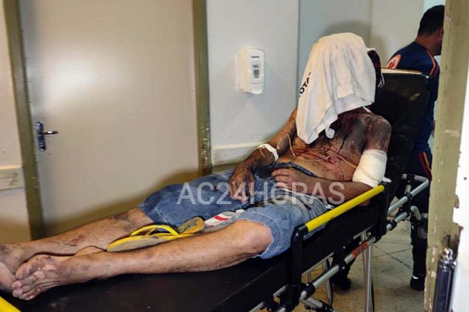 DE SURPRESA - Homem é abordado e ferido a facadas em beco - News Rondônia