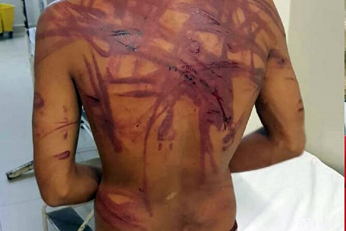 CRISTAL DA CALAMA - Jovem acusado de assalto é sequestrado e espancado - News Rondônia