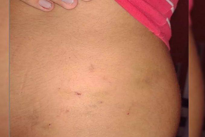 Garota de 16 anos denuncia que foi estuprada por oito homens e polícia investiga o caso - News Rondônia