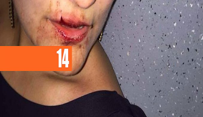 HOMEM É PRESO APÓS DESFERIR MURROS NA BOCA DA ESPOSA EM VILA DE APARTAMENTO - News Rondônia