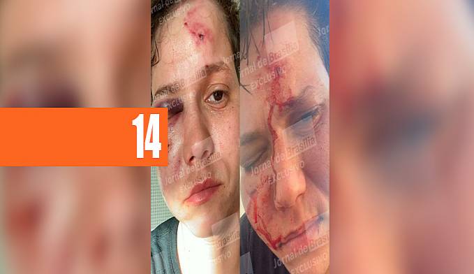 BRUTALIDADE: KAROL ELLER, LIGADA A BOLSONARO, É AGREDIDA NA BARRA DA TIJUCA - News Rondônia