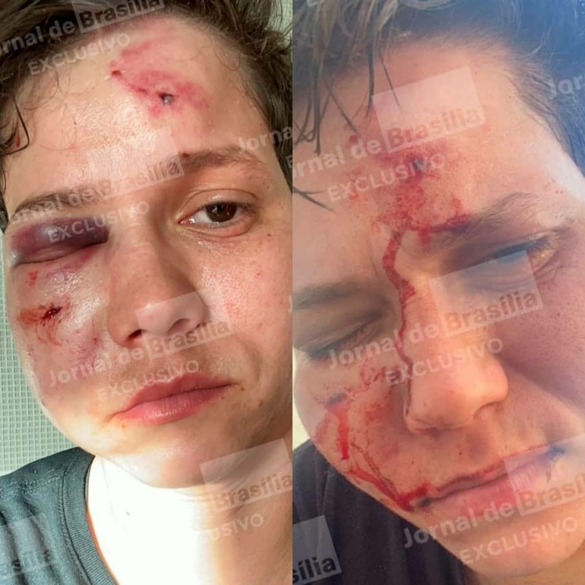 BRUTALIDADE: KAROL ELLER, LIGADA A BOLSONARO, É AGREDIDA NA BARRA DA TIJUCA - News Rondônia