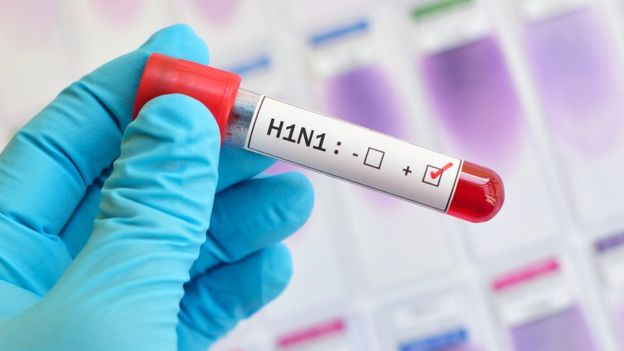 SAIBA POR QUE O H1N1 NÃO PAROU ECONOMIAS COMO A PANDEMIA DE CORONAVÍRUS? - News Rondônia