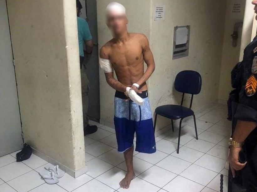 PRESO ADOLESCENTE SEM PERNA QUE APARECE EM VÍDEO PRATICANDO ASSALTO - News Rondônia