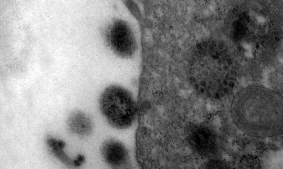 Covid-19: anticorpos podem durar até 12 meses após infecção - News Rondônia