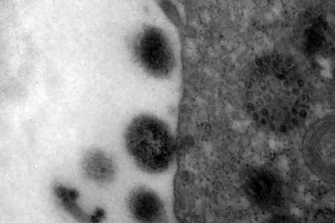 Covid-19: anticorpos podem durar até 12 meses após infecção - News Rondônia