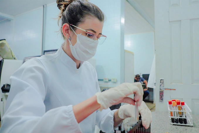 Mais de 820 mil exames foram realizados em 2021 pelo Laboratório Central de Porto Velho - News Rondônia