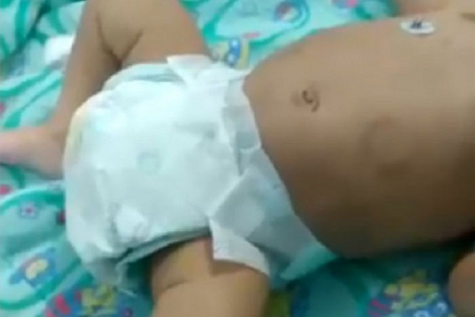 MONSTRUOSIDADE - Bebê perde rim após ser espancado pelo próprio pai - News Rondônia