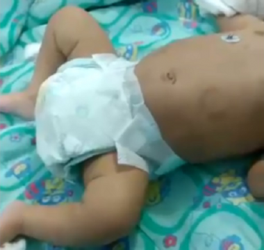 MONSTRUOSIDADE - Bebê perde rim após ser espancado pelo próprio pai - News Rondônia