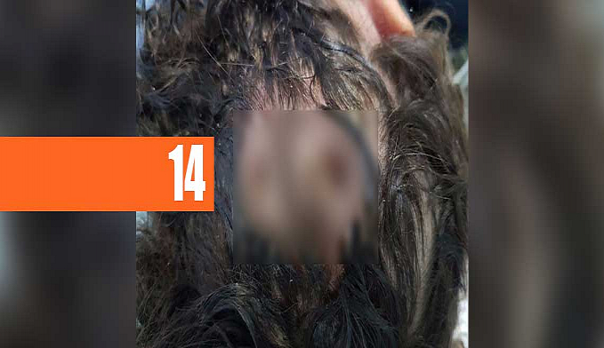 MÃE DE MENINA COM LARVAS NA CABEÇA ESTÁ COM MEDO DE SER LINCHADA - News Rondônia
