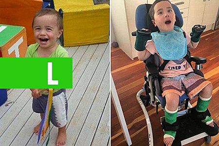 GAROTO FICA PARAPLÉGICO APÓS ENGASGAR COM PEDAÇO DE MAÇÃ E CASO SERVE DE ALERTA - News Rondônia