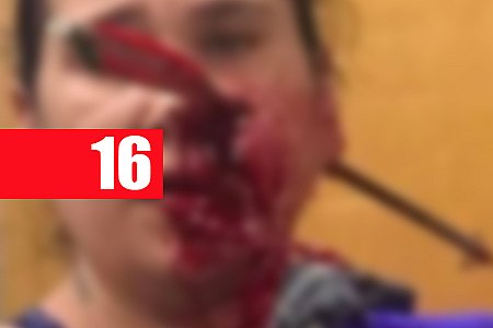 MÃE FICA COM FLECHA CRAVADA NO ROSTO AO SALVAR FILHO DURANTE BRIGA - News Rondônia