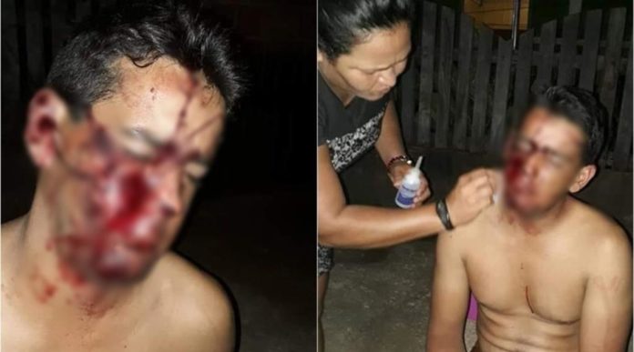 RETIRADA DE MANIFESTANTES DA BR EM NOVA CALIFÓRNIA TEM RELATOS DE AGRESSÃO; VEJA O VÍDEO - News Rondônia