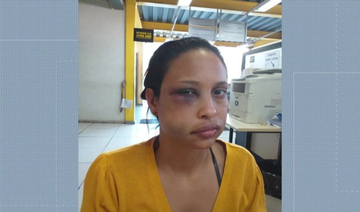 ELE ME BATEU ATÉ EU DESMAIAR, DIZ JOVEM ESPANCADA POR EX-BOTAFOGO - News Rondônia